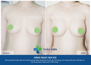 Nguyễn Vy Phương 24t, cao 1m64 nặng 54kg, gel 801-01  